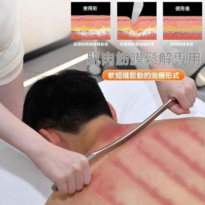筋膜刀 刮痧板 肌肉筋膜鬆解專用, 1個, 304不鏽鋼(送翻毛袋),M刀長度40cm(厚度8mm)