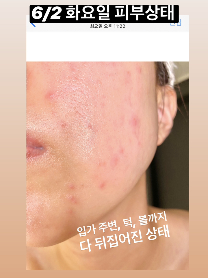 쿠팡 상품 솔직 후기 | 실사용자 리뷰 분석 썸네일