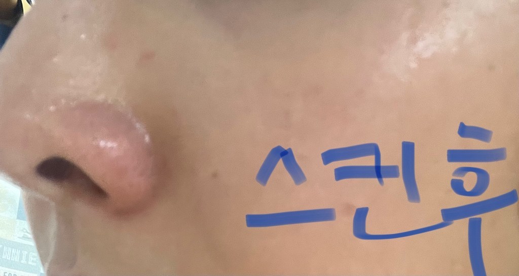 토리든 다이브인 저분자 히알루론산 토너 솔직 후기 | 실사용자 리뷰 분석 - 상품 이미지 4
