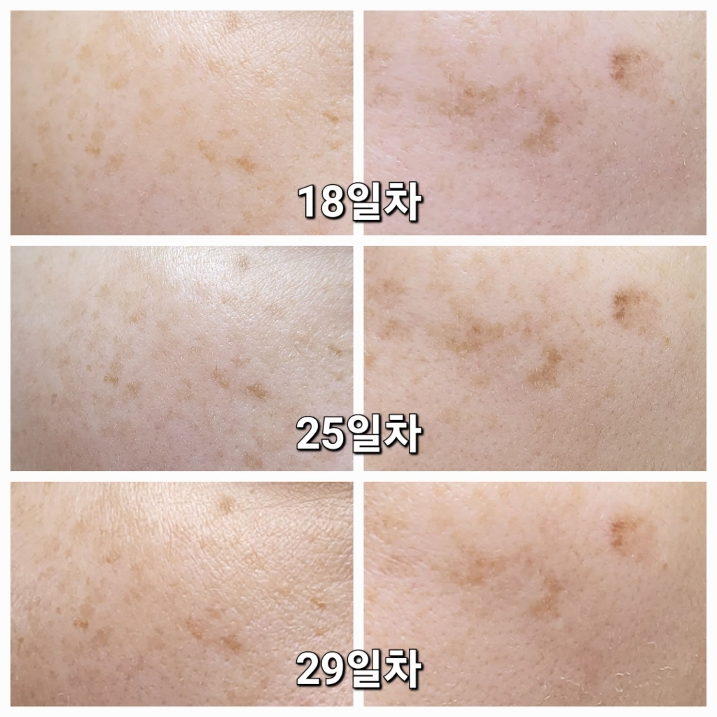 라비엘 아세로라 잡티 앤 기미 케어 크림 솔직 후기 | 실사용자 리뷰 분석 - 상품 이미지 4