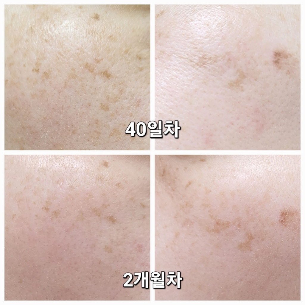 라비엘 아세로라 잡티 앤 기미 케어 크림 이미지 3