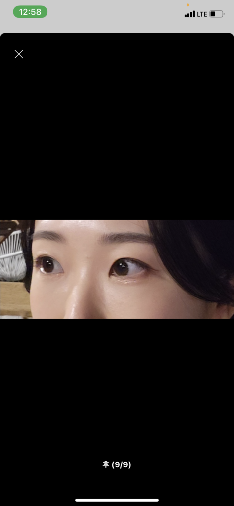 케이시크릿 비타민C 아이패치 (기미패치) 기미관리 눈밑주름 미간주름 이미지 3