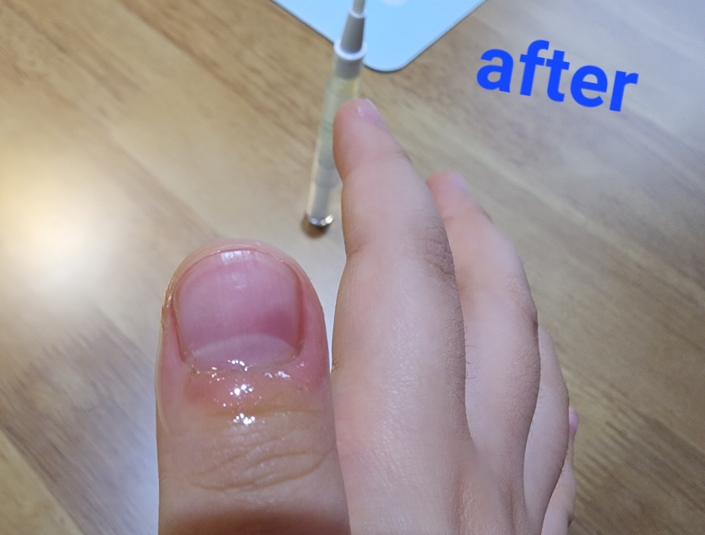 바렌 네일 & 큐티클 케어 에센스 오일 펜 이미지 4