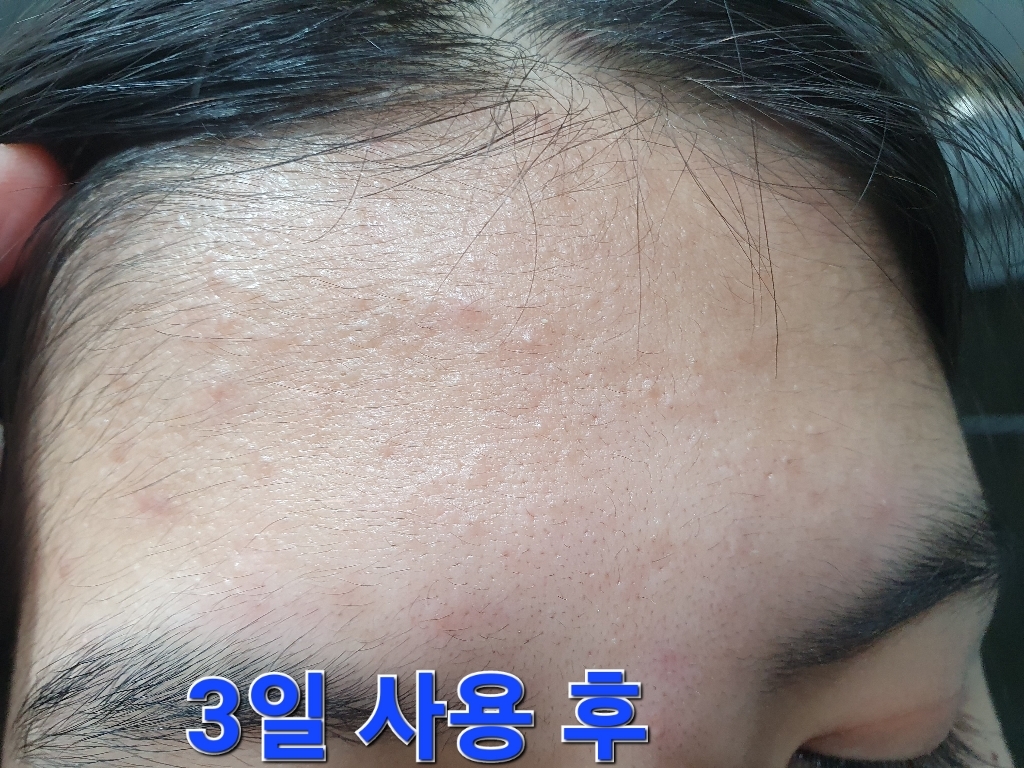 쿠피 연어 PH 아크네 클렌징 젤 이미지 4