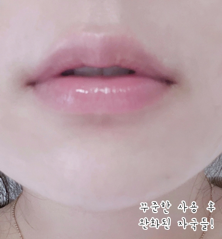 [색소침착/미백] 마일드랩 딥 멜라케어 앰플 30ml 이미지 3