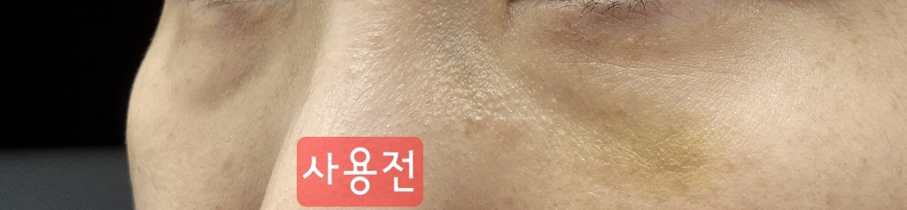 샤르드 아이백 리프트 1100샷 리들 아이패치 아이백 눈가리프팅 솔직 후기 | 피부 타입별 분석 - 상품 이미지 3