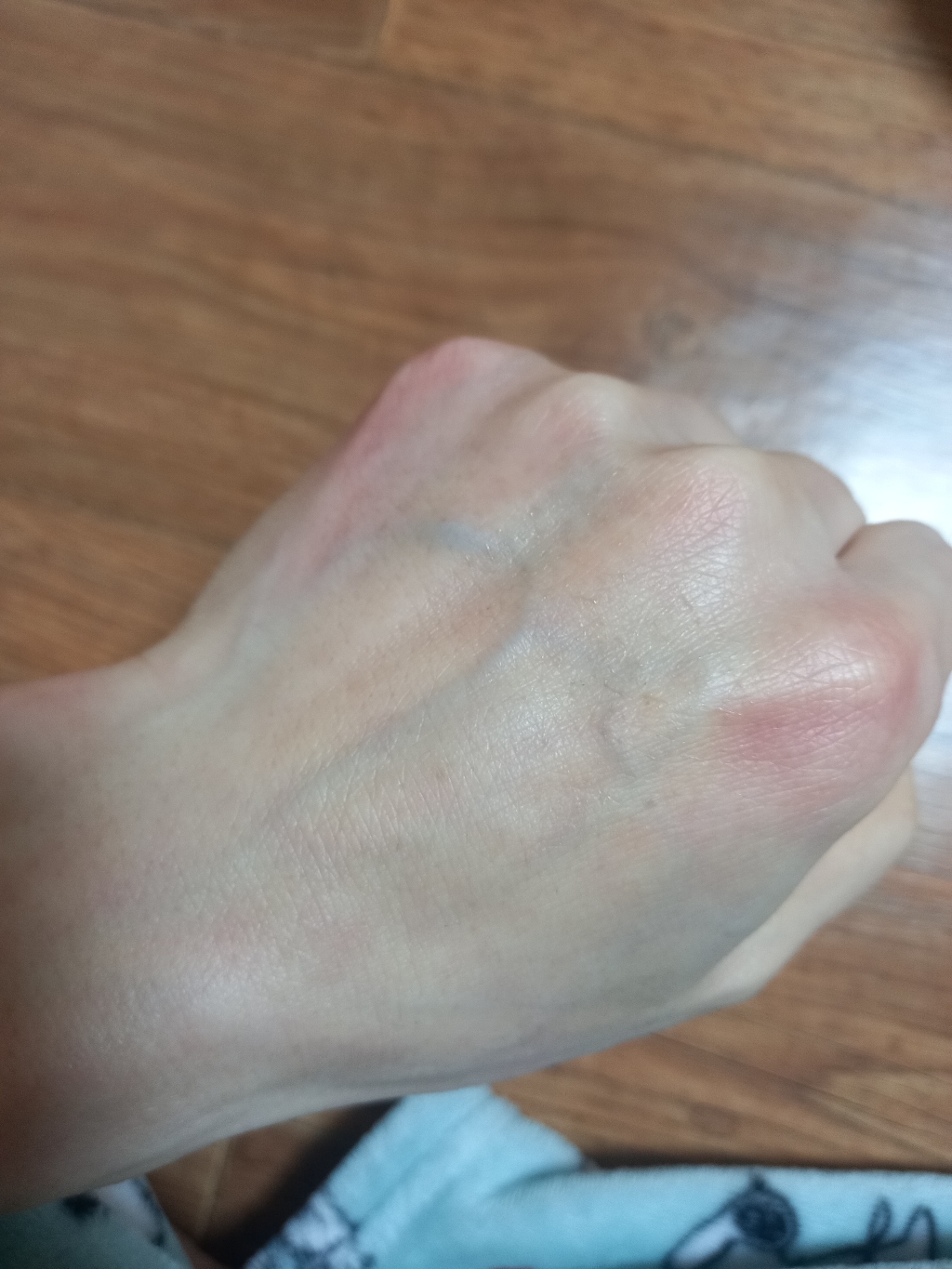 동국제약 마데카 크림 시즌5 이미지 4