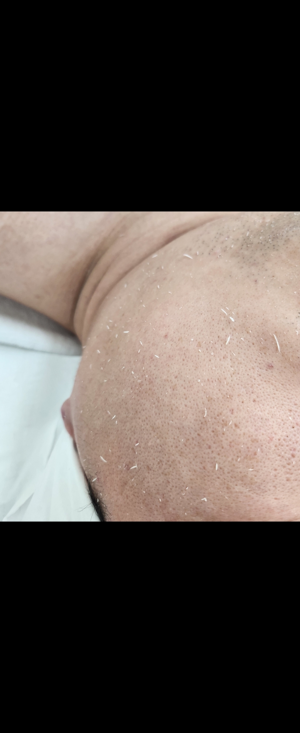 셀프미인 아미코스 실기시험용 고마쥐 200ml 피부 미용 재료 솔직 후기 | 피부 타입별 분석 - 상품 이미지 3