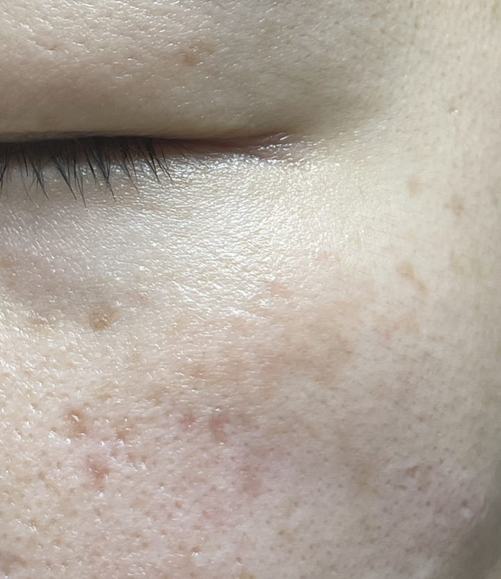 더마팩토리 나이아신아마이드 20% 세럼 이미지 4