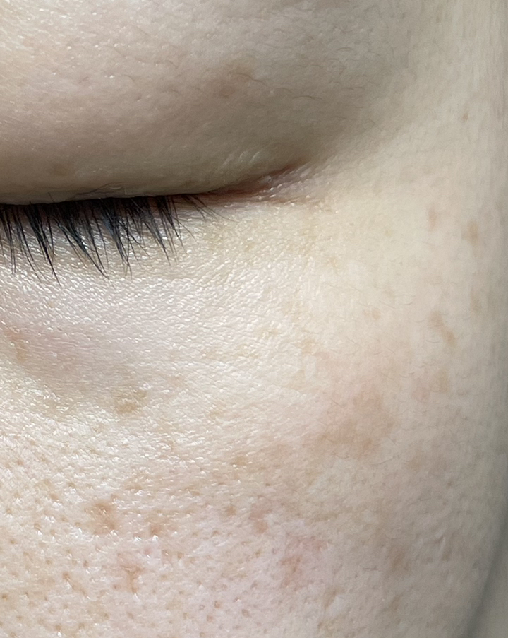 더마팩토리 나이아신아마이드 20% 세럼 이미지 3