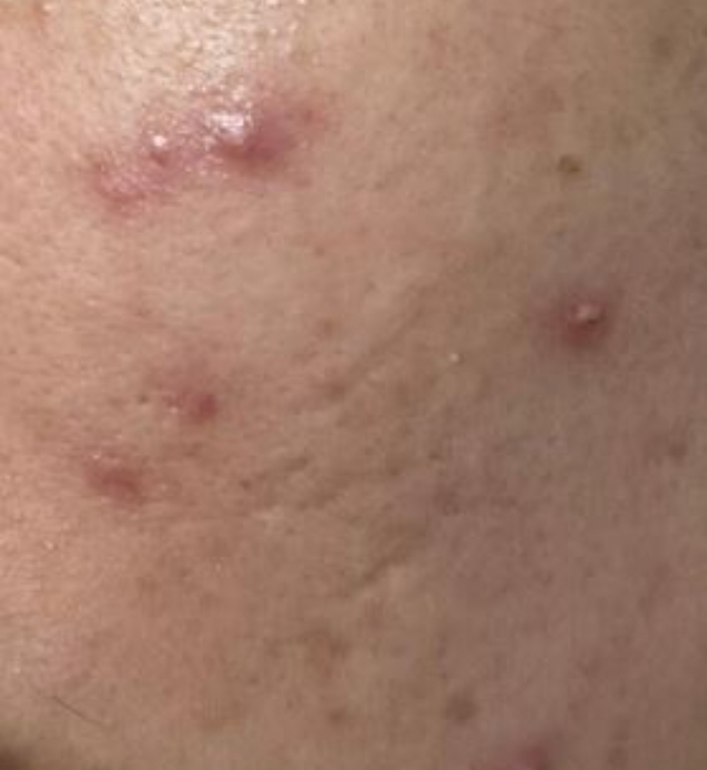 #오오티디뷰티 별모양 패치 스타 스팟 패치 솔직 후기 | 실사용자 리뷰 분석 - 상품 이미지 2