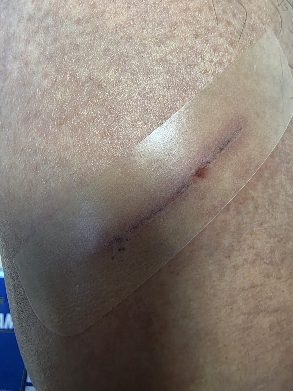 메디폼 H 씬 재생밴드 2p 실사용 후기 | 효과 있을까? - 상품 이미지 4