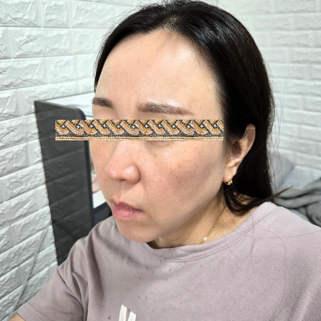 메디필 펩타이드9 아쿠아 볼륨 톡스 프로 미스트 솔직 후기 | 실사용자 리뷰 분석 - 상품 이미지 4