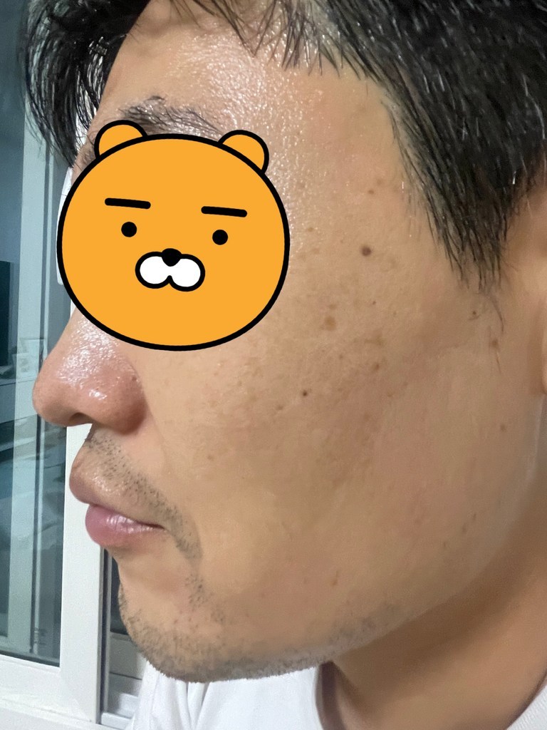 더페이스샵 닥터벨머 집중탄력 마스크림 텐션시트 집중수분 이미지 4