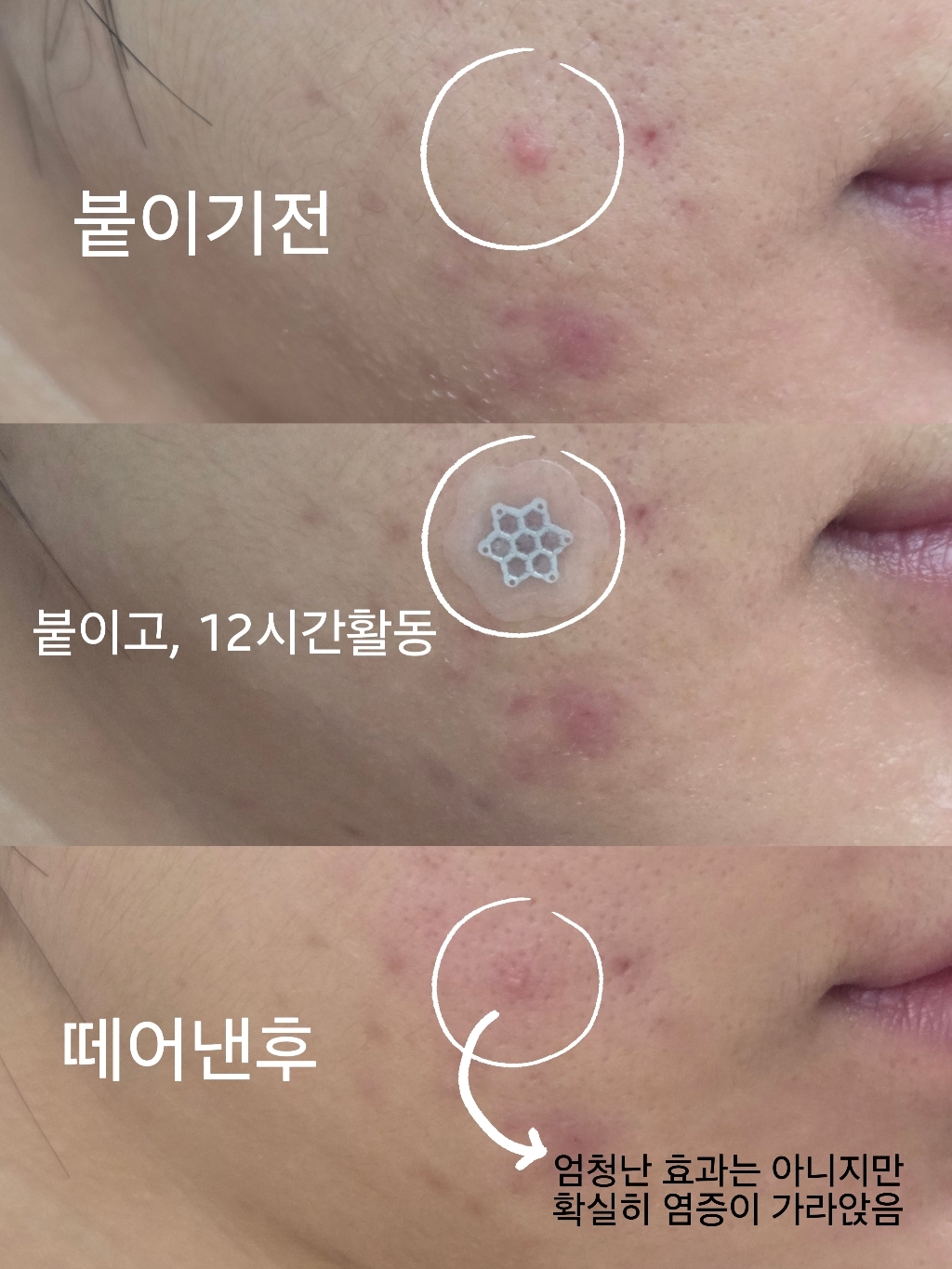 AC 마그네슘 패치 소형 솔직 후기 | 실사용자 리뷰 분석 - 상품 이미지 4