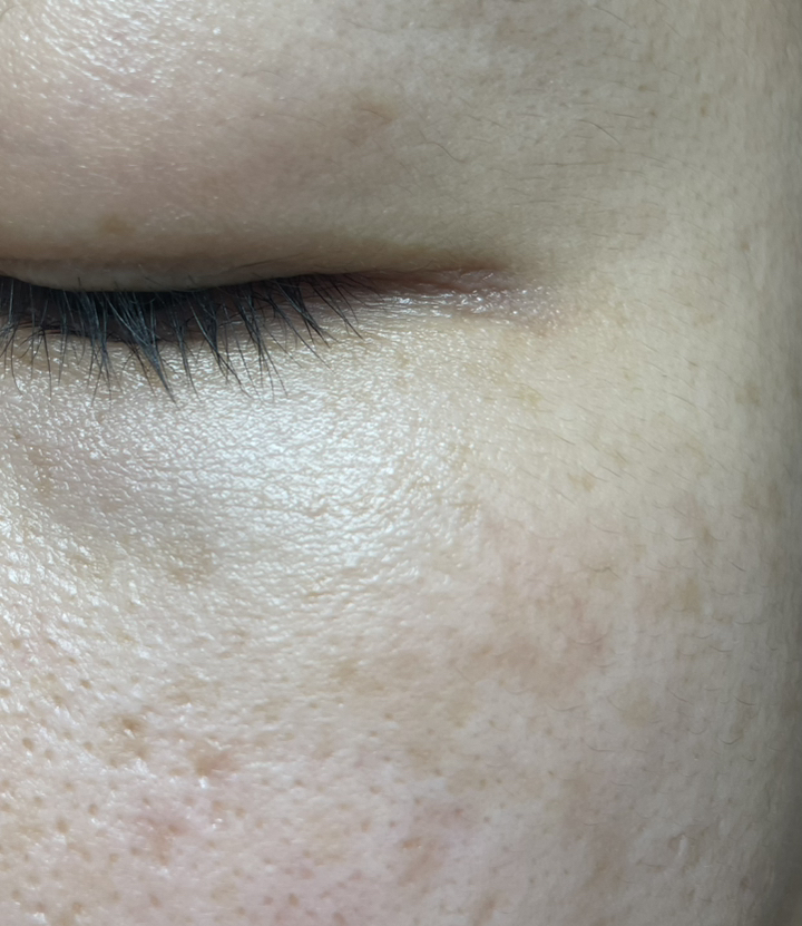 더마팩토리 나이아신아마이드 20% 세럼 이미지 2