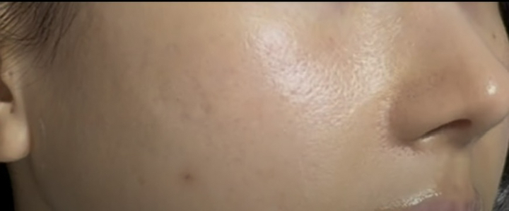 제로이드 핌프로브 레드 컨트롤 크림 pH4 이미지 3