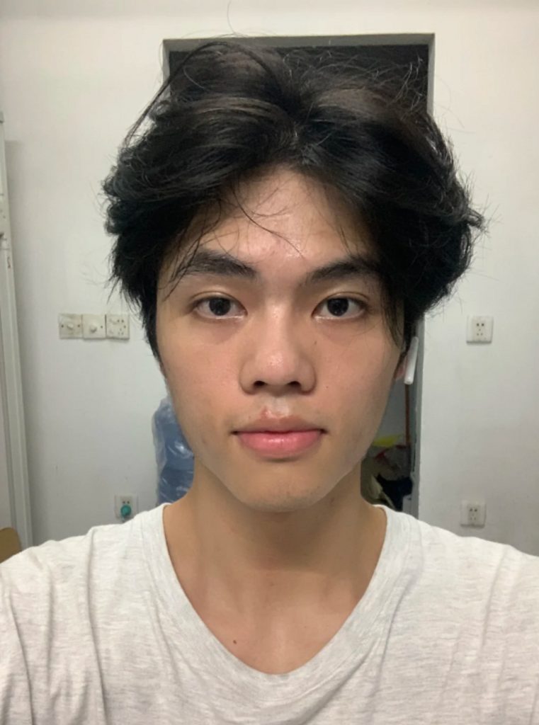 남성검버섯 제거 크림1위 크림 기미크림 기미 잡티 주근깨 검버섯 제거 크림 착색 미백 크림 들깨기미크림 색소침착 화이트닝 이미지 3