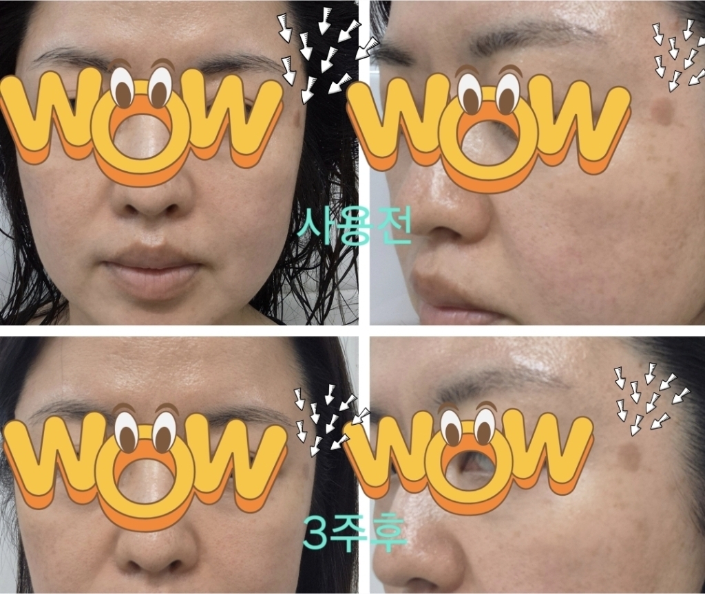 렌티고논 크림 얼굴 기미케어 피부톤 브라이트닝 관리 이미지 4