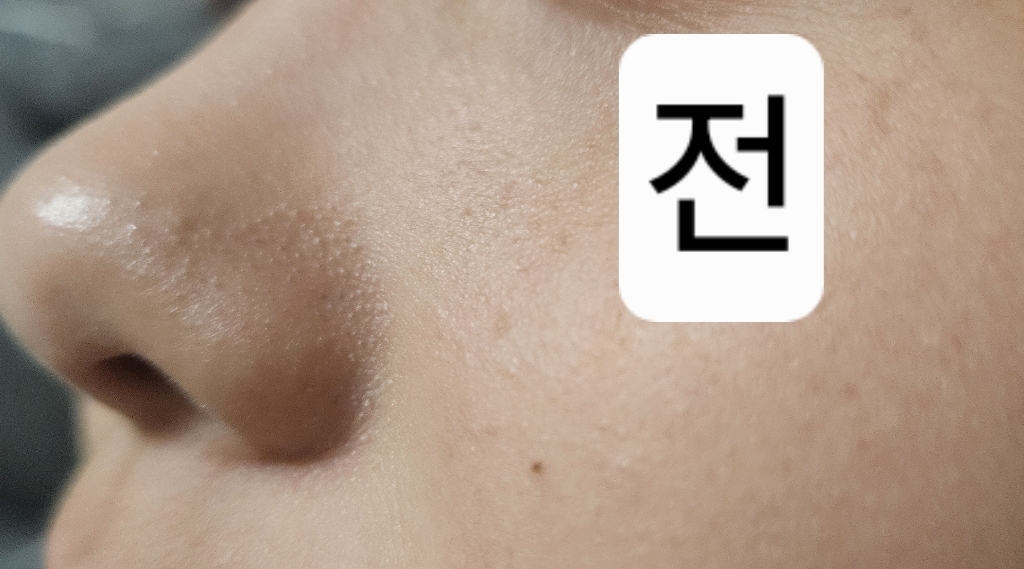 [피부과 추천] 1/1+1 블랙헤드 코팩 코 블랙헤드 제거 팩 죽탄 페이... 솔직 후기 | 실사용자 리뷰 분석 썸네일