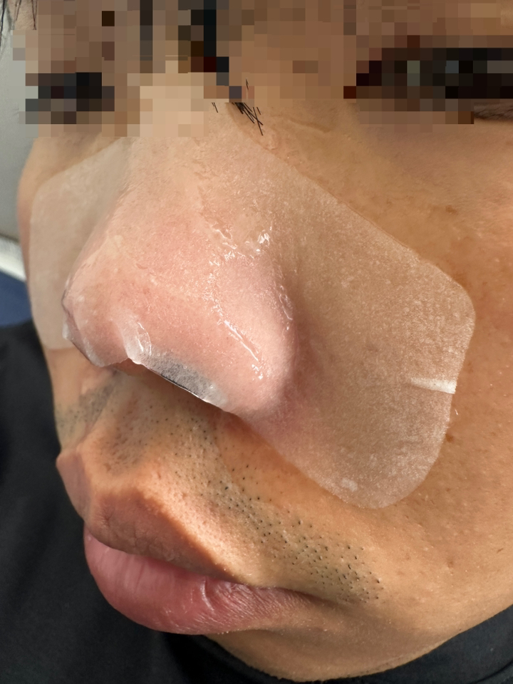 메디힐 블랙헤드 멜팅 클리어 코팩 4매 + 스패출러 2개 솔직 후기 | 실사용자 리뷰 분석 - 상품 이미지 1