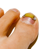 L (16 x 4.5 mm) × 1세트