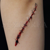 SFX.3D상처_꿰맨상처_#일자(중)_기본 × 1개
