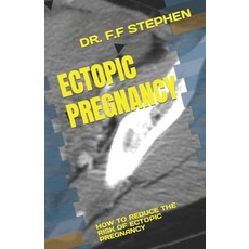 (英文圖書) Ectopic Pregnancy: How to Reduce the Risk of Ectopic Pregnancy 平裝版, Independently Published, 英文