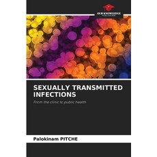 (英文圖書) Sexually Transmitted Infections 平裝版, Our Knowledge Publishing, 英文