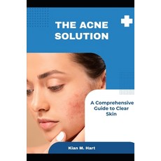 (英文圖書) The Acne Solution: A Comprehensive Guide to Clear Skin 平裝版, Independently Published, 英文