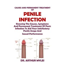 (英文圖書) Causes and Permanent Treatment of Penile Infection: Knowing The Causes Symptom... 平裝版, Independently Published, 英文