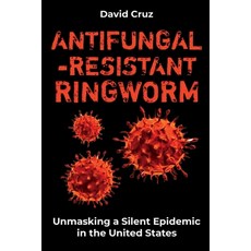 (英文圖書) Antifungal-Resistant Ringworm: Unmasking a Silent Epidemic in the United States 平裝版, Independently Published, 英文