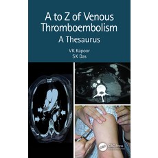 (英文圖書) A to Z of Venous Thromboembolism 平裝版, CRC Press, 英文