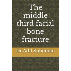 (英文圖書) The middle third facial bone fracture 平裝版, Independently Published, 英文