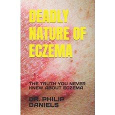 (英文圖書) Deadly Nature of Eczema: The Truth You Never Knew about Eczema 平裝版, Independently Published, 英文