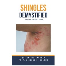 (英文圖書) Shingles Demystified: Doctor's Secret Guide 平裝版, Virtued Press, 英文