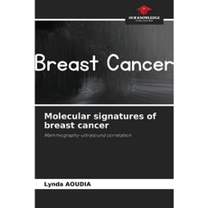 (英文圖書) Molecular signatures of breast cancer 平裝版, Our Knowledge Publishing, 英文