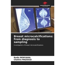 (英文圖書) Breast microcalcifications: from diagnosis to sampling 平裝版, Our Knowledge Publishing, 英文