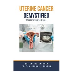 (英文圖書) Uterine Cancer Demystified Doctors Secret Guide 平裝版, Virtued Press, 英文