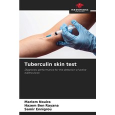 (英文圖書) Tuberculin skin test 平裝版, Our Knowledge Publishing, 英文