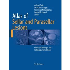 Atlas of Sellar and Parasellar Lesions: Clinical Radiologic and Pathologic Correlations 平裝版, Springer, 英文