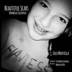 (英文圖書) Beautiful Scars Hermosas Cicatrices 平裝版, Createspace Independent Pub..., 英文