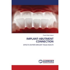 (英文圖書) Implant-Abutment Connection 平裝版, LAP Lambert Academic Publis..., 英文