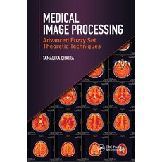 (英文圖書) Medical Image Processing 平裝版, CRC Press, 英文