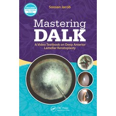 (英文圖書) Mastering DALK: A Video Textbook on Deep Anterior Lamellar Keratoplasty 平裝版, CRC Press, 英文