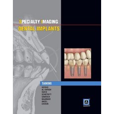 Specialty Imaging: Dental Implants 精裝版, Amirsys, 英文