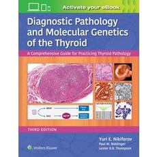 Diagnostic Pathology and Molecular Genetics of the Thyroid: A Comprehensive Guide for Practicing Thy... 精裝版, LWW, 英文