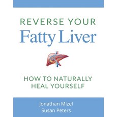 (英文圖書) Reverse Your Fatty Liver: How To Naturally Heal Yourself 平裝版, Createspace Independent Pub..., 英文