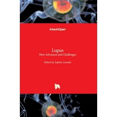(英文圖書) Lupus: New Advances and Challenges 精裝版, Intechopen, 英文