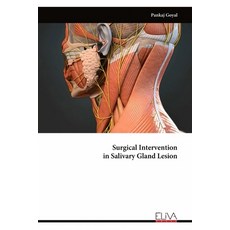(英文圖書) Surgical Intervention in Salivary Gland Lesion 平裝版, Eliva Press, 英文